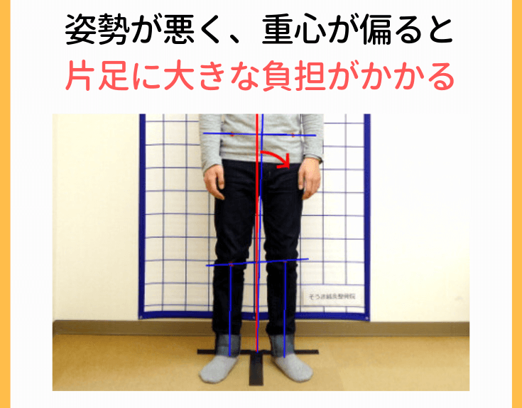 体重のかかり方の偏り