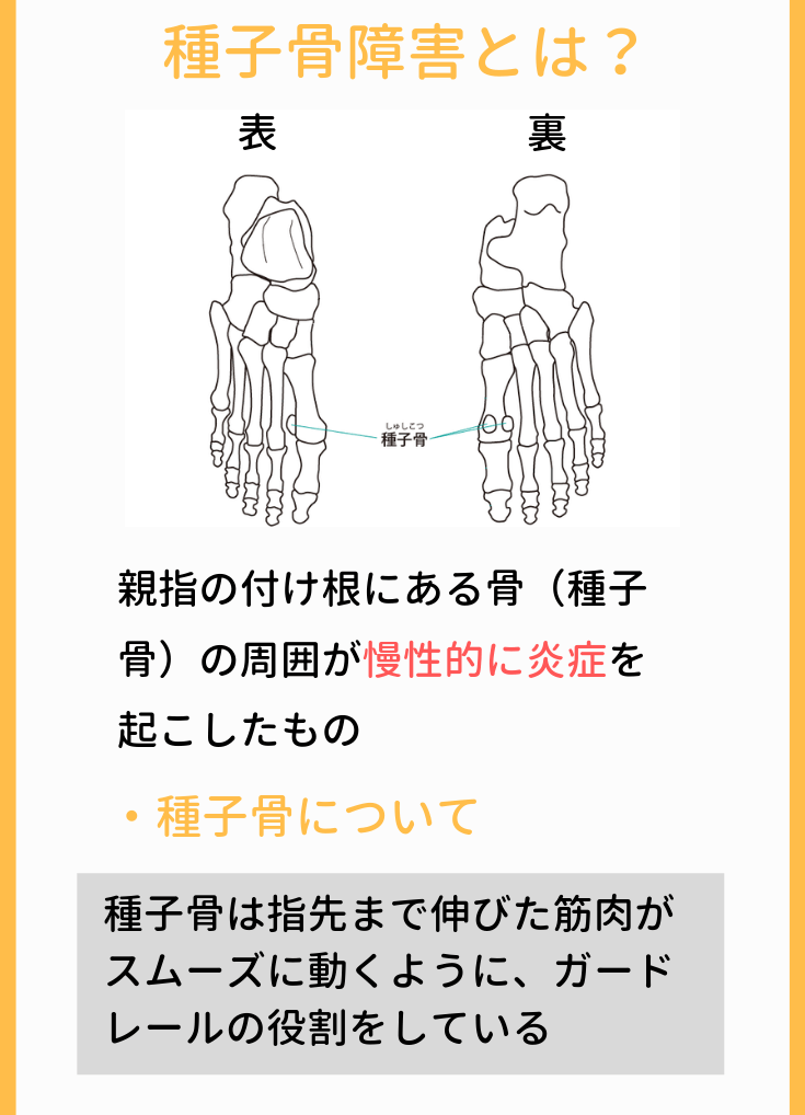 種子骨障害とは？