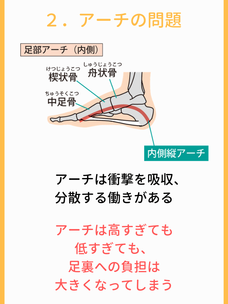 アーチの問題