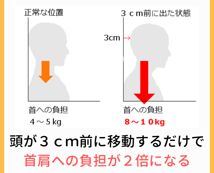 首や肩の慢性的なこり