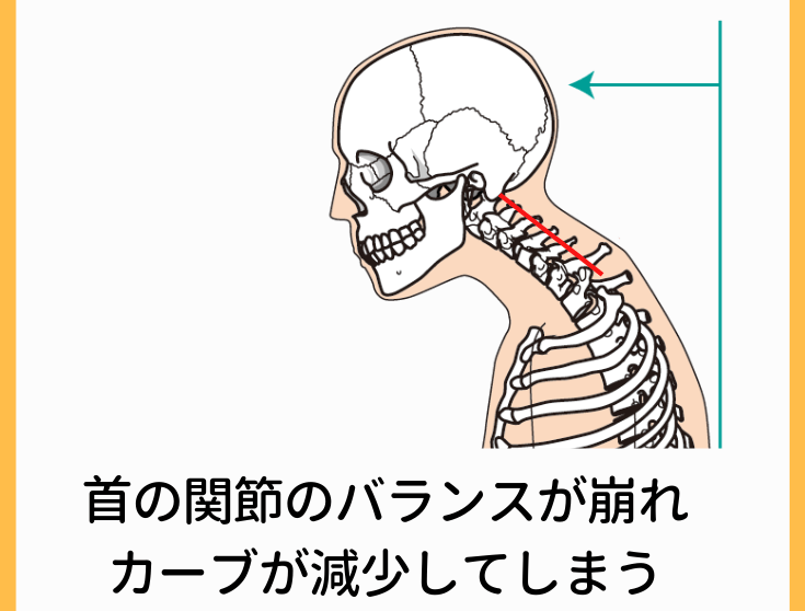 首や肩の慢性的なこり