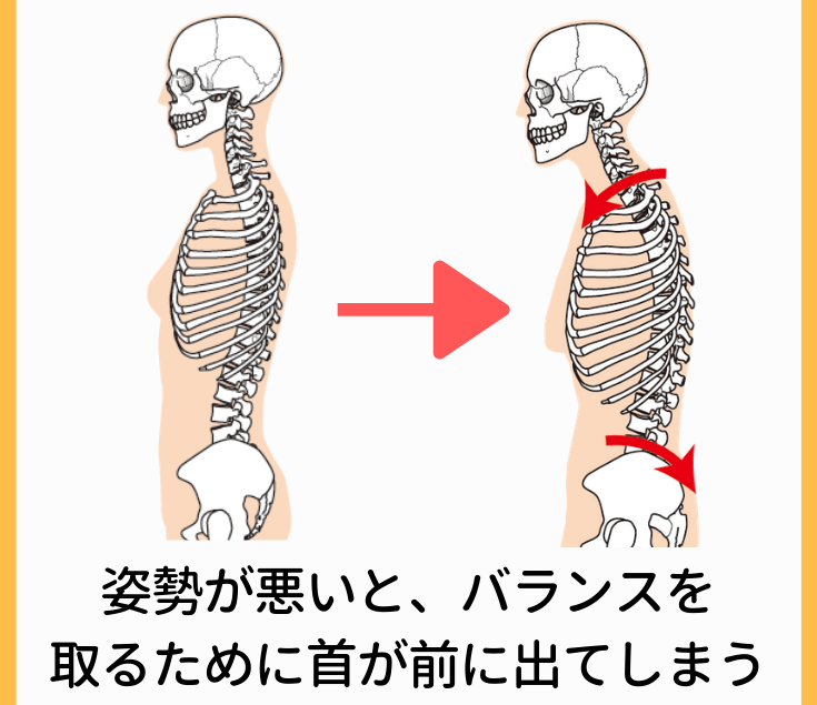 首や肩の慢性的なこり